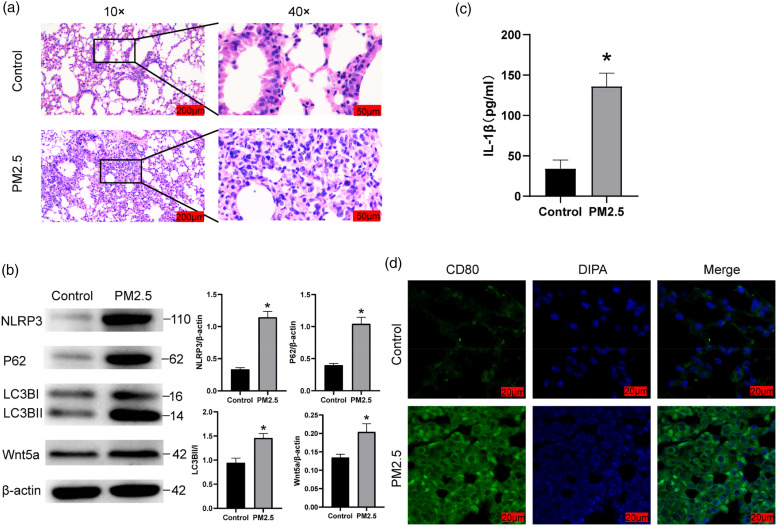 PM2.5 activated NLRP3 inflammasome and IL-1β release in MH-S cells by facilitating autophagy via activating Wnt5a.
