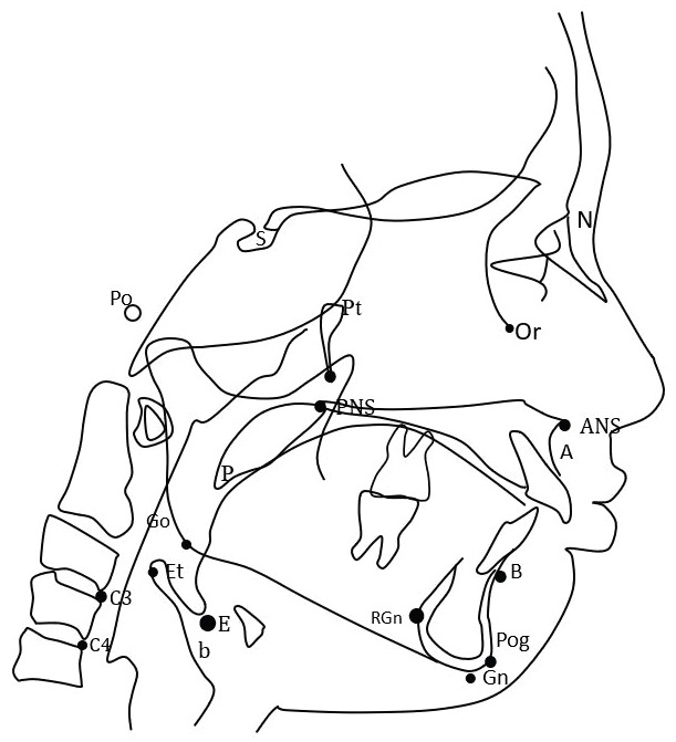 Changes in airway patency and sleep-breathing in healthy skeletal Class II children undergoing functional activator therapy.