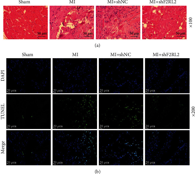 lncRNA NEAT1 Downregulation Ameliorates the Myocardial Infarction of Mice by Regulating the miR-582-5p/F2RL2 Axis.