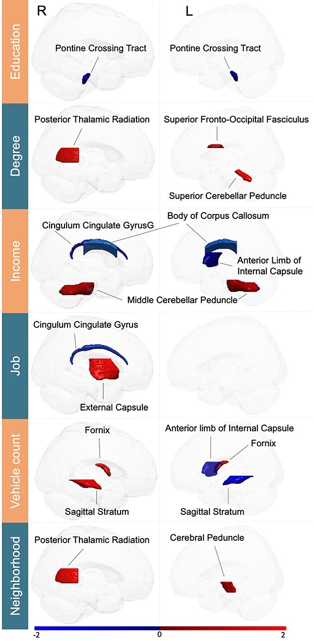 Pattern learning reveals brain asymmetry to be linked to socioeconomic status.