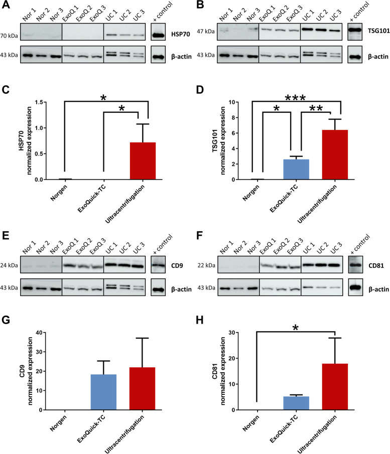 Proteomic analysis of extracellular vesicles secreted by primary human epithelial endometrial cells reveals key proteins related to embryo implantation.