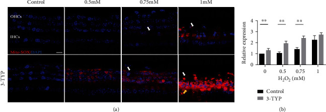 ROS-Induced Oxidative Damage and Mitochondrial Dysfunction Mediated by Inhibition of SIRT3 in Cultured Cochlear Cells.