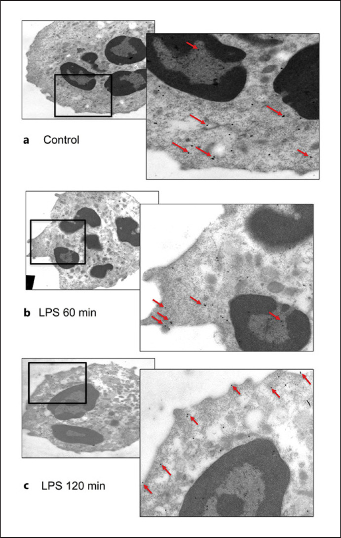 Regulation of TLR10 Expression and Its Role in Chemotaxis of Human Neutrophils.