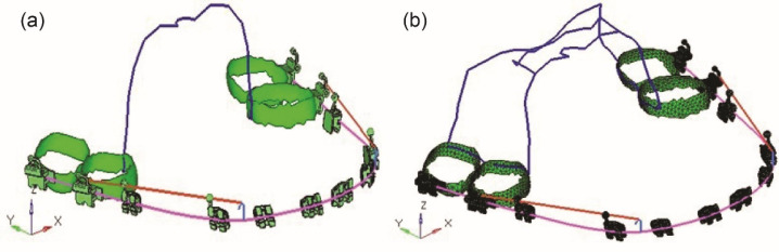 Comparison of the effectiveness of butterfly arch versus transpalatal arch in anchorage reinforcement: A linear 3D finite element study.