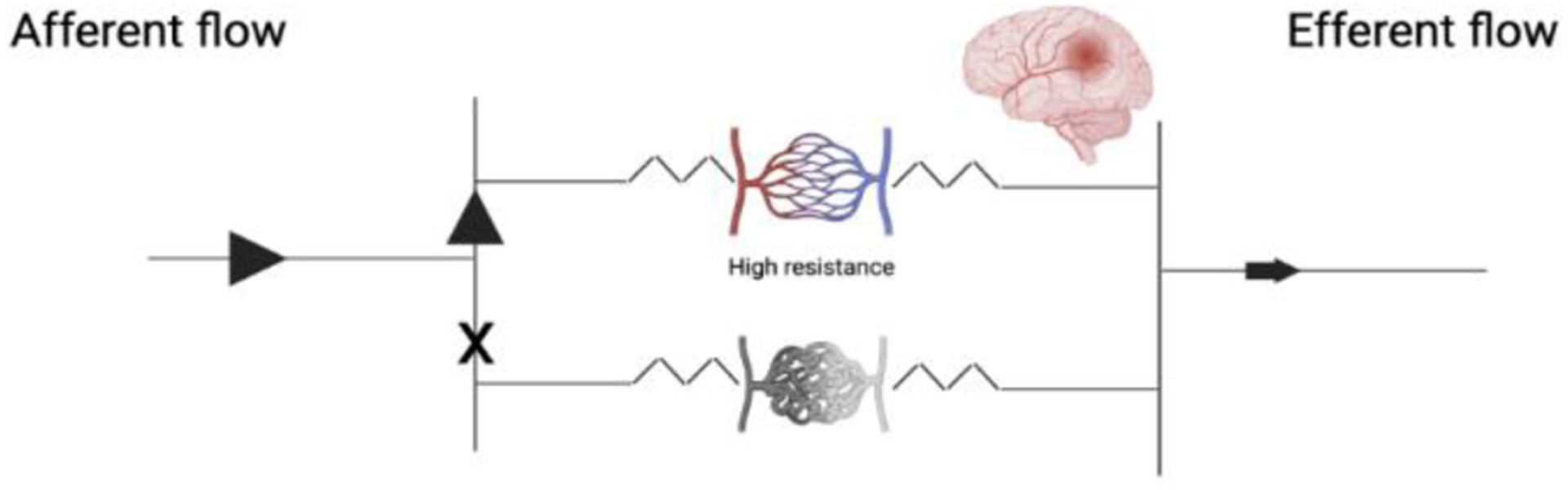 Venous Outflow for Brain Arteriovenous Malformations: Overview and Treatment Implications.