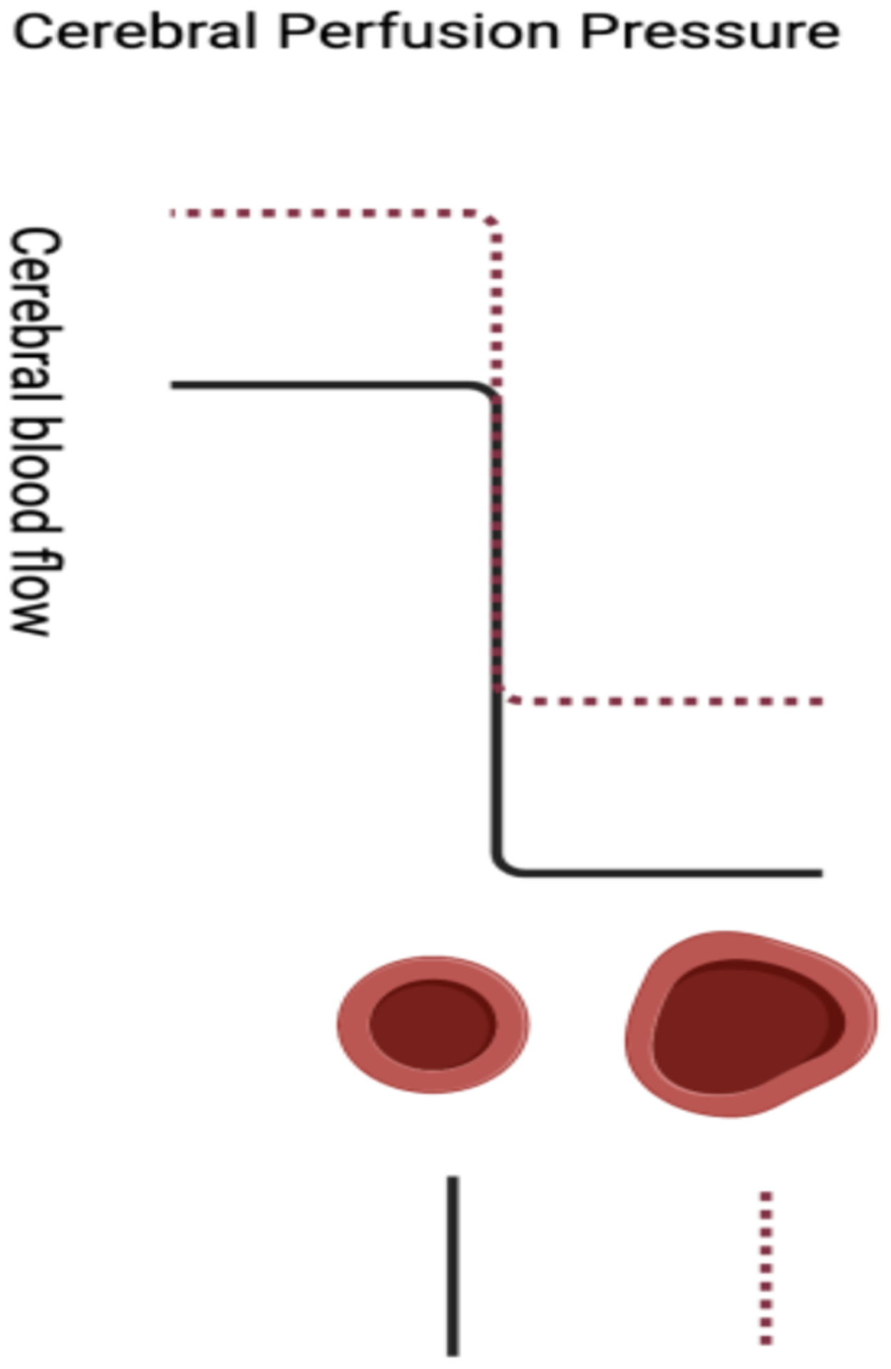 Venous Outflow for Brain Arteriovenous Malformations: Overview and Treatment Implications.