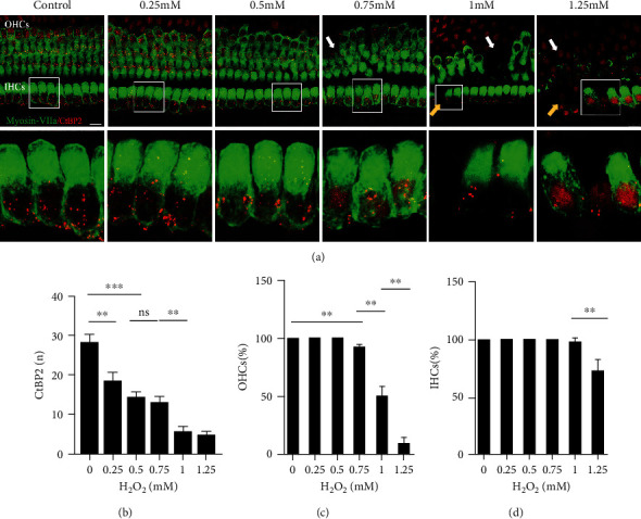 ROS-Induced Oxidative Damage and Mitochondrial Dysfunction Mediated by Inhibition of SIRT3 in Cultured Cochlear Cells.