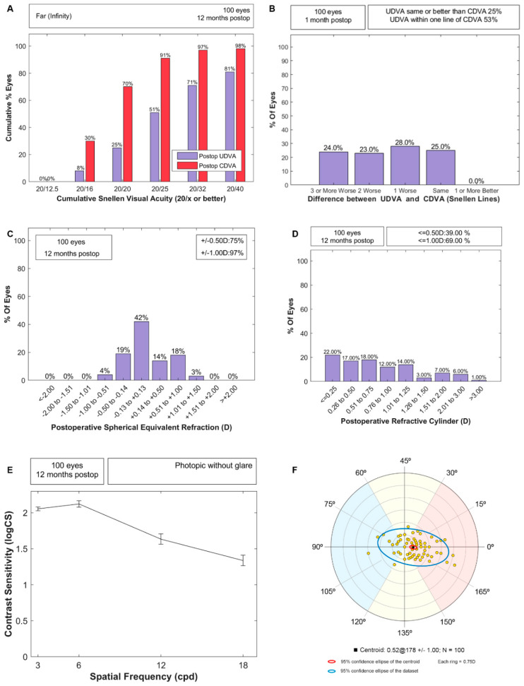 Prediction Error Stabilization and Long-Term Standard Results with a Monofocal Intraocular Lens.