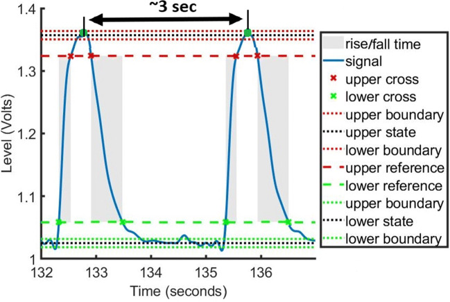 An E-Textile Respiration Sensing System for NICU Monitoring: Design and Validation.