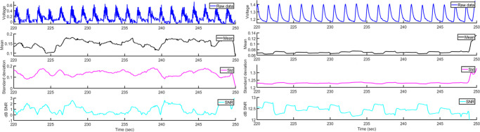 An E-Textile Respiration Sensing System for NICU Monitoring: Design and Validation.