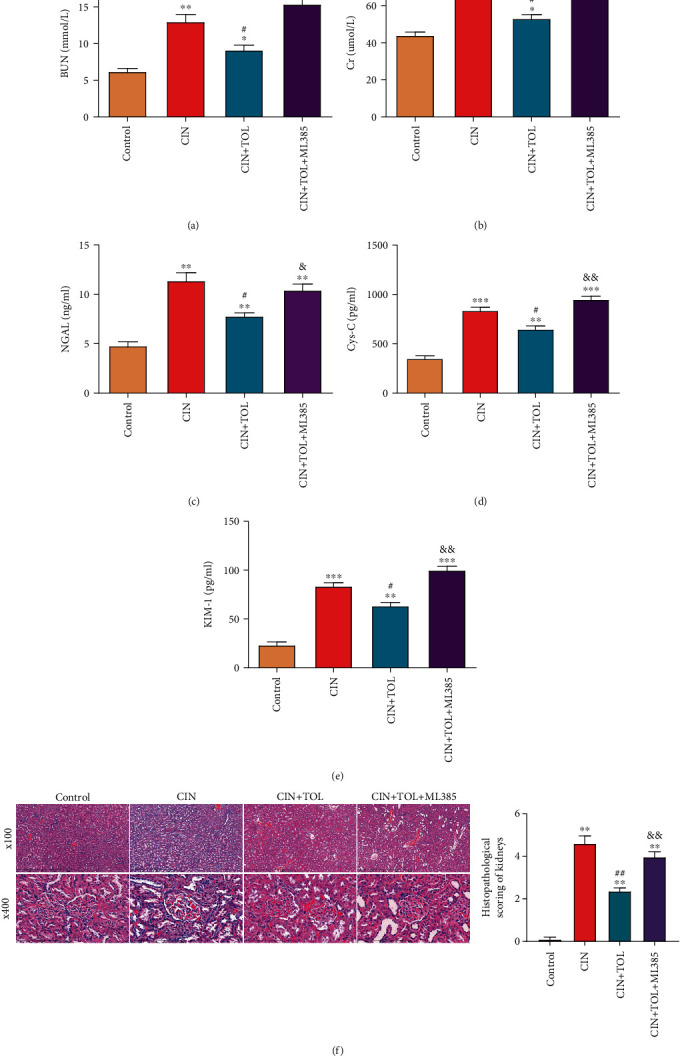 Tolvaptan Improves Contrast-Induced Acute Kidney Injury.