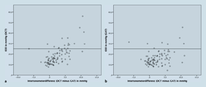 [Intraocular pressure elevation after vitrectomy-Goldmann applanation tonometry measures lower intraocular pressure than dynamic contour tonometry].