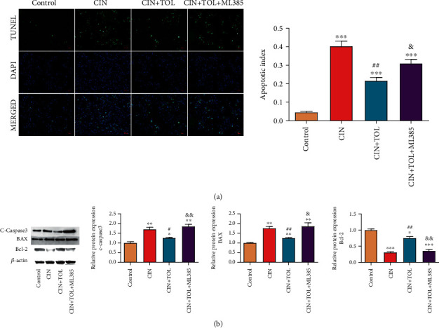 Tolvaptan Improves Contrast-Induced Acute Kidney Injury.