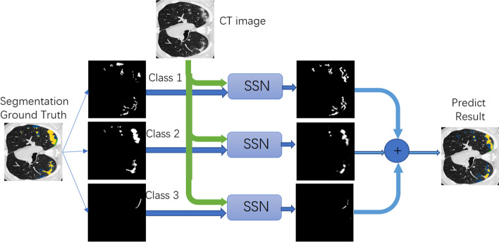 A deep adversarial model for segmentation-assisted COVID-19 diagnosis using CT images.