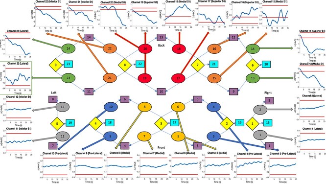 Measuring "pain load" during general anesthesia.