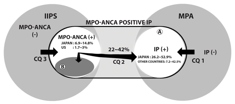 MPO-ANCA positive interstitial pneumonia: Current knowledge and future perspectives.