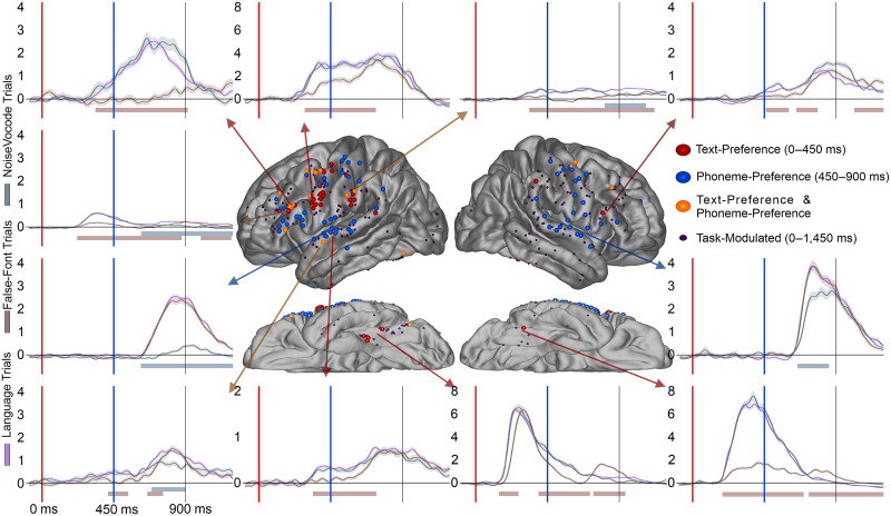 The Precentral Gyrus Contributions to the Early Time-Course of Grapheme-to-Phoneme Conversion.