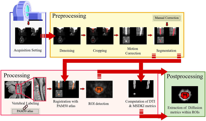 Diffusion Kurtosis Imaging of Neonatal Spinal Cord in Clinical Routine.