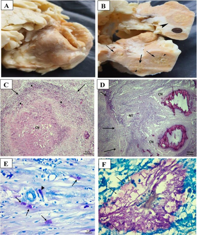 Molecular characterization of <i>Mycobacterium bovis</i> strains isolated from cattle and humans by spoligotyping and 24-locus MIRU-VNTR, and prevalence of positive IGRA in slaughterhouse workers in Southern Turkey.