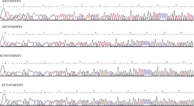 Disproportionate Distribution of HBV Genotypes A and D and the Recombinant Genotype D/E in the High and Low HBV Endemic Regions of Uganda: A Wake-Up Call for Regional Specific HBV Management.