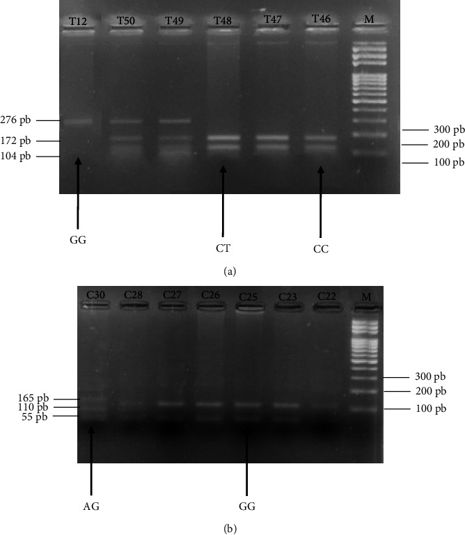 Carriage of Ser217Leu and Ala541Thr Variants of ELAC2 Gene and Risk Factors in Patients with Prostate Cancer in Burkina Faso.