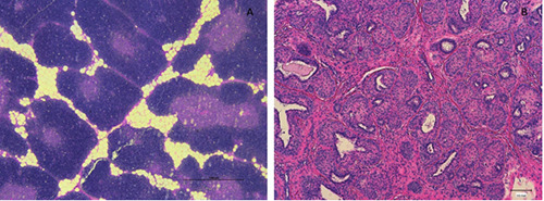 The Italian strategy to fight illegal treatment with growth promoters: Results of the 2017-2019 histological monitoring plan.