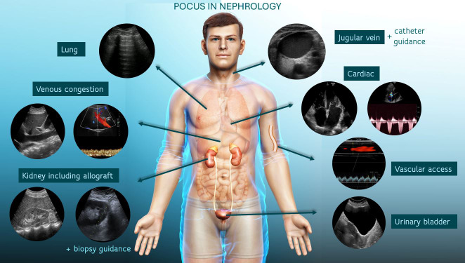 About the Special Kidney Issue.