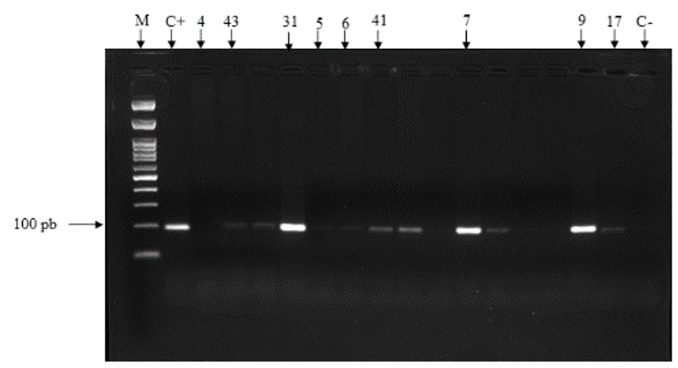 Evaluation of techniques for diagnosis of Trypanosoma vivax infections in naturally infected cattle in the Zona da Mata Mineira.