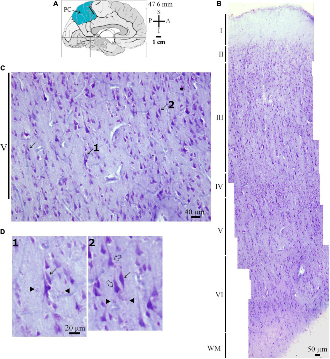 Spindle-Shaped Neurons in the Human Posteromedial (Precuneus) Cortex.