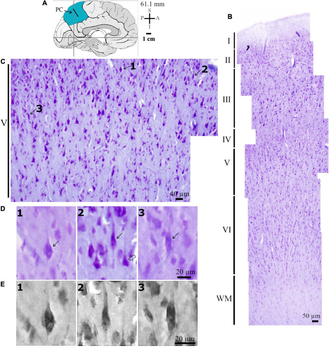 Spindle-Shaped Neurons in the Human Posteromedial (Precuneus) Cortex.