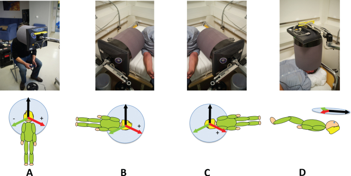 Long-duration head down bed rest as an analog of microgravity: Effects on the static perception of upright.