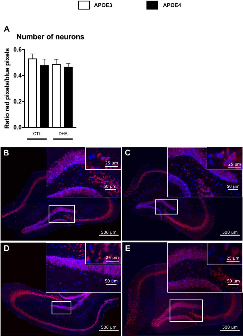 A diet rich in docosahexaenoic acid enhances reactive astrogliosis and ramified microglia morphology in apolipoprotein E epsilon 4-targeted replacement mice