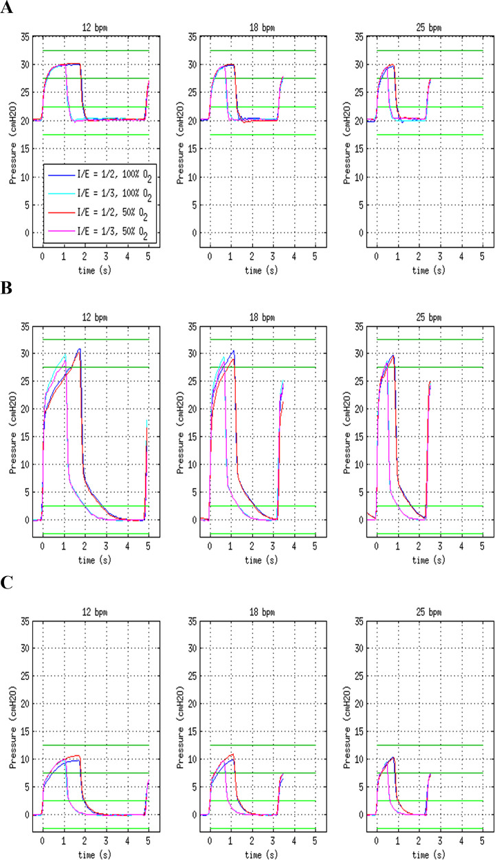 Robust, maintainable, emergency invasive mechanical ventilator.