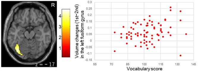 Academic achievements and brain volume development in children and adolescents.