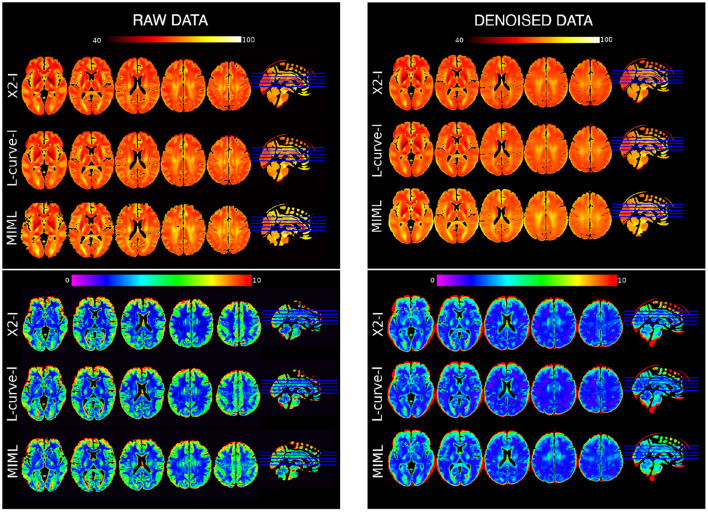 Variability and reproducibility of multi-echo <i>T</i><sub>2</sub> relaxometry: Insights from multi-site, multi-session and multi-subject MRI acquisitions.