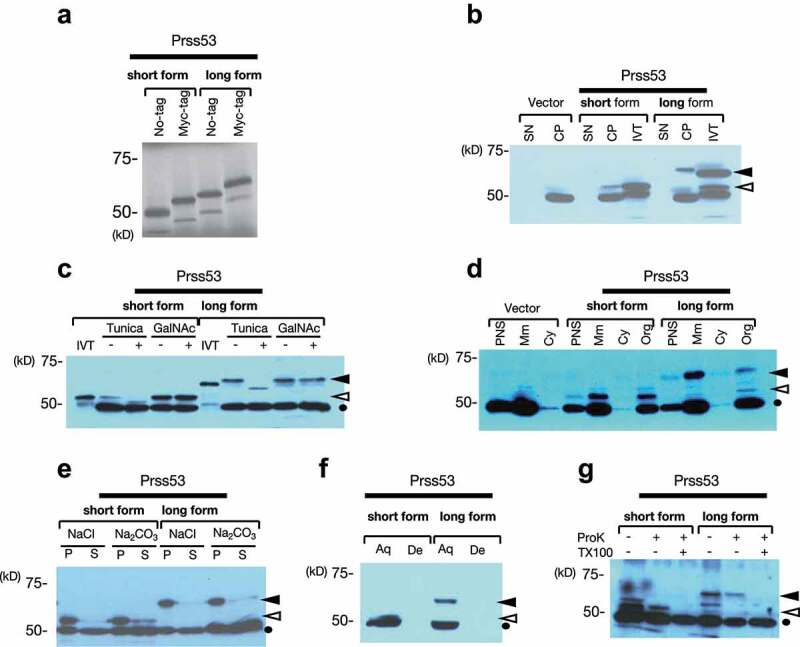 Identification of protease serine S1 family member 53 as a mitochondrial protein in murine islet beta cells.