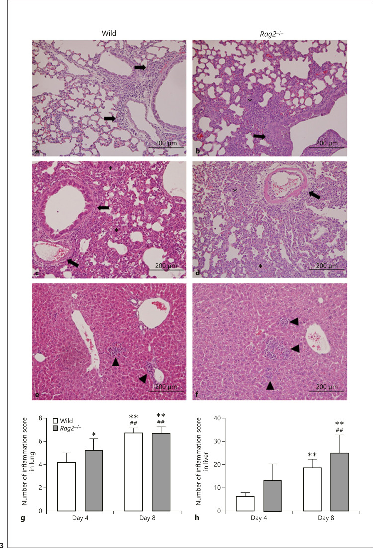 Rag2 Deficiency Enhances Susceptibility to Systemic Mouse Adenovirus Type 1 Infection.