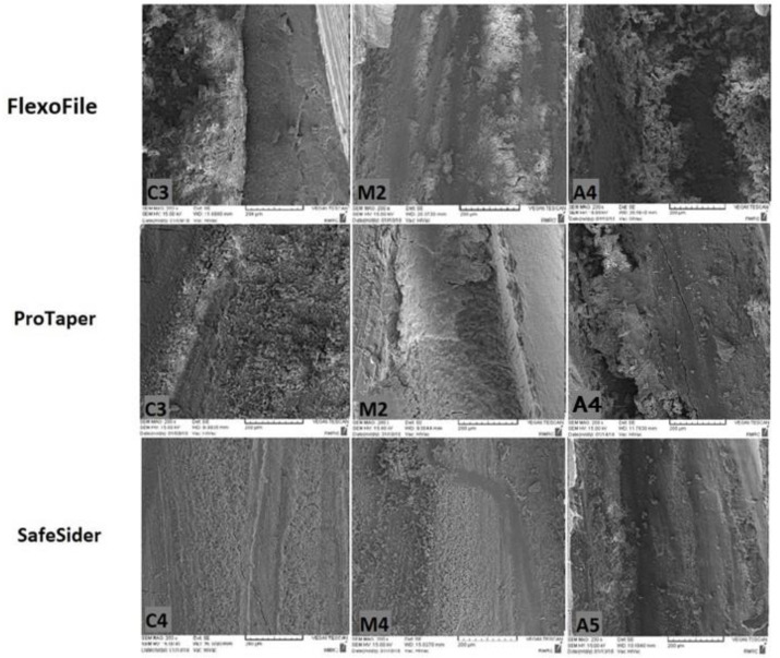 Evaluation of Residual Debris and Smear layer After Root Canal Preparation by Three Different Methods: A Scanning Electron Microscopy Study.