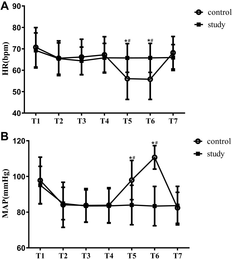 The Effect of Trigeminal Ganglion Block on Trigeminocardiac Reflex in Elderly Patients with Trigeminal Neuralgia Undergoing Percutaneous Balloon Compression: A Randomized Controlled Study.