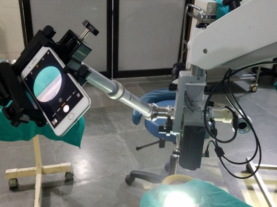 Ophthalmic Telesurgery with a Low-Cost Smartphone Video System for Surgeon Self-Reflection and Remote Synchronous Consultation: A Qualitative and Quantitative Study.