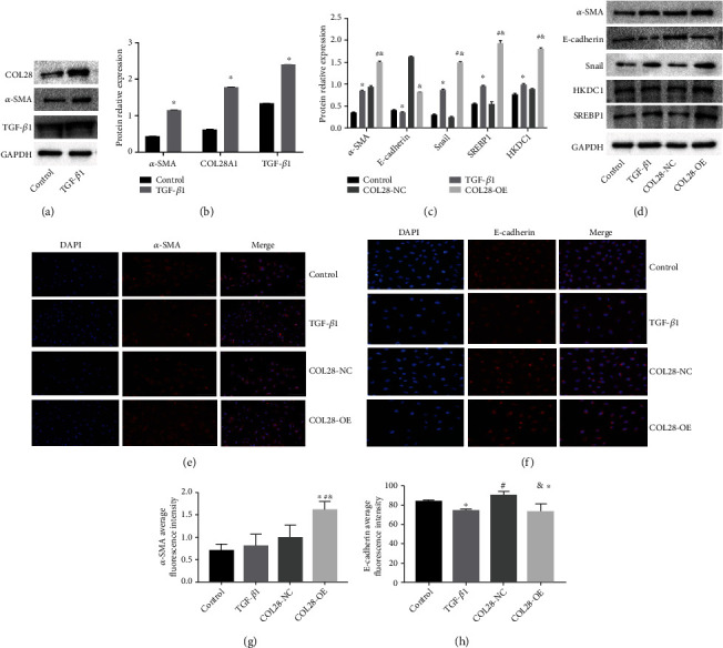 Type XXVIII Collagen Regulates Renal Interstitial Fibrosis and Epithelial-Mesenchymal Transition by SREBP1-Mediated HKDC1 Expression.