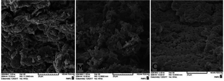 Evaluation of Residual Debris and Smear layer After Root Canal Preparation by Three Different Methods: A Scanning Electron Microscopy Study.