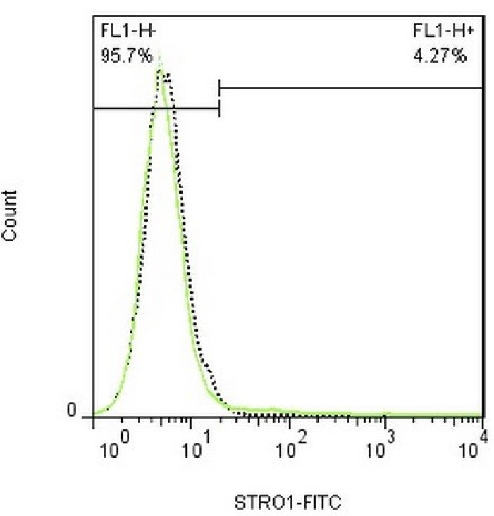 Attachment of human periodontal ligament fibroblasts to root dentin conditioned with different endodontic irrigants: An experimental study.