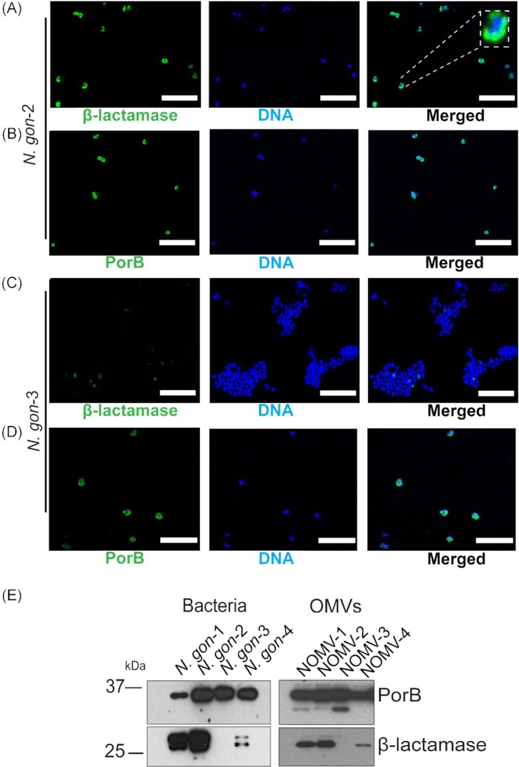 <i>Neisseria gonorrhoeae</i>-derived outer membrane vesicles package β-lactamases to promote antibiotic resistance.