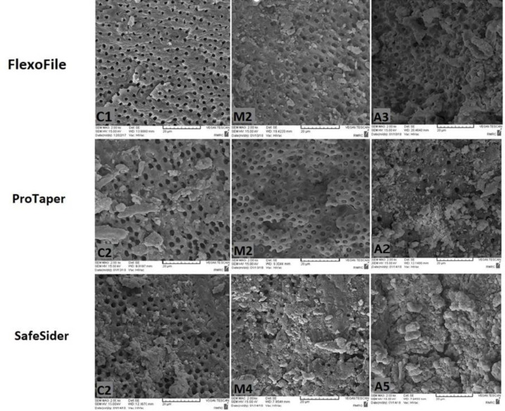 Evaluation of Residual Debris and Smear layer After Root Canal Preparation by Three Different Methods: A Scanning Electron Microscopy Study.