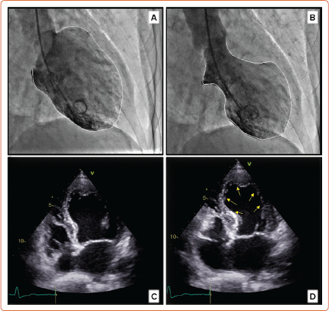 Imaging in Women with Heart Failure: Sex-specific Characteristics and Current Challenges.