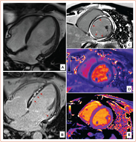 Imaging in Women with Heart Failure: Sex-specific Characteristics and Current Challenges.