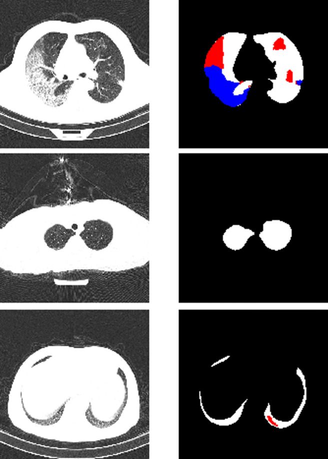 COVID-CT-Mask-Net: prediction of COVID-19 from CT scans using regional features