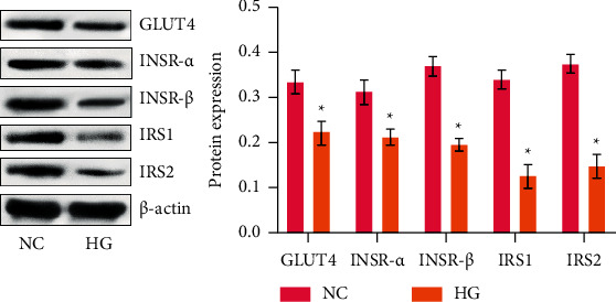 Upregulation of Klotho Aggravates Insulin Resistance in Gestational Diabetes Mellitus Trophoblast Cells.