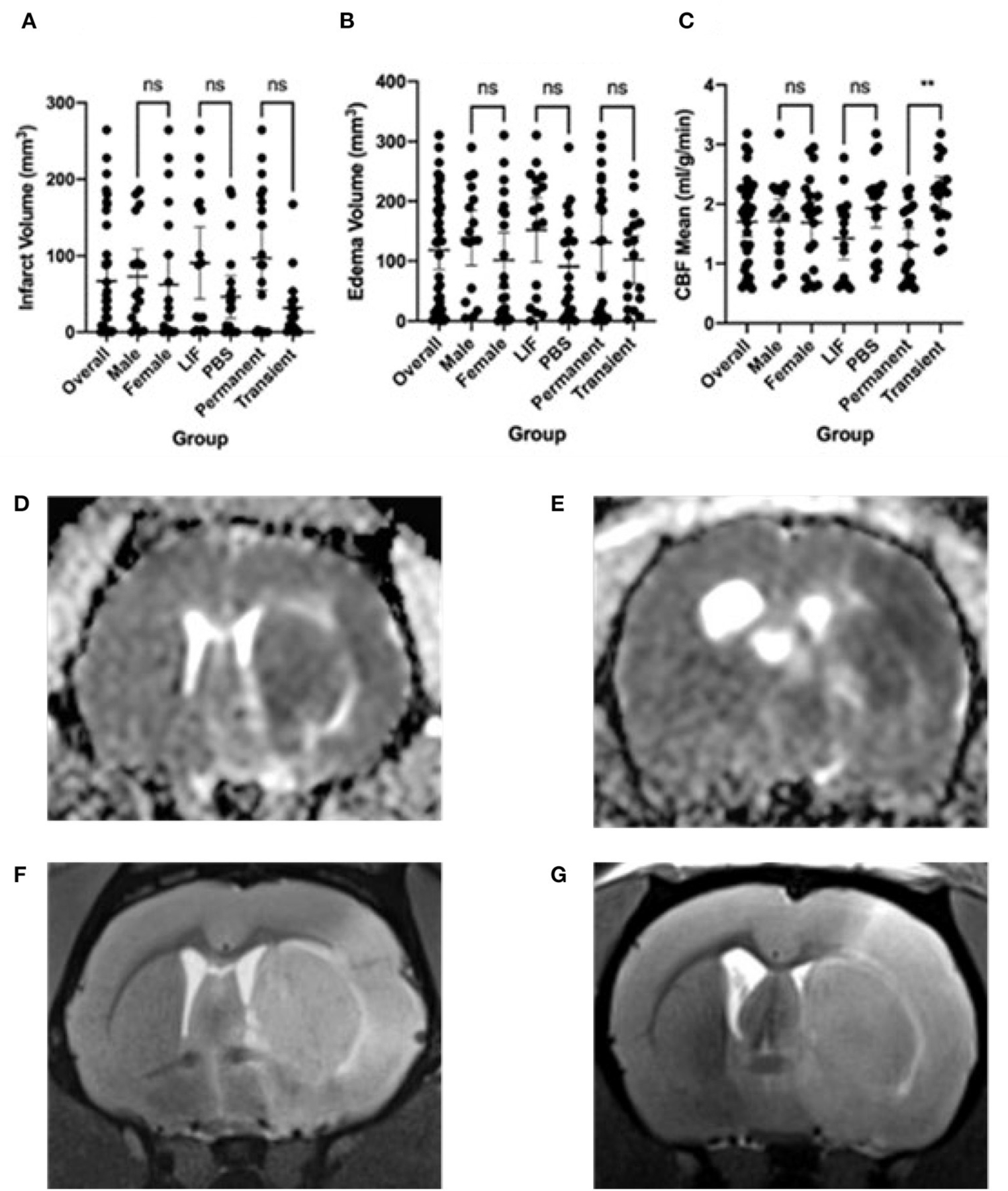 Gut microbial dysbiosis correlates with stroke severity markers in aged rats.